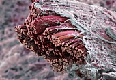 Skeletal muscle fibres,SEM