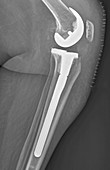 X-ray of artificial knee joint