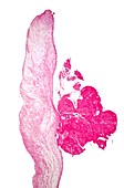 Heart growth,light micrograph