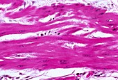 Pregnant uterus wall,light micrograph