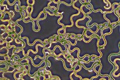 Spirulina cyanobacteria,light micrograph