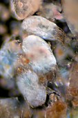 House dust mites,light micrograph