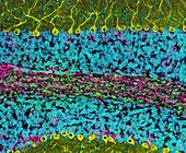 Cerebellum tissue,light micrograph