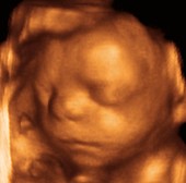 Foetus at 26 weeks,3-D ultrasound scan