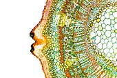 Plant breathing pore,light micrograph