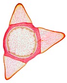 Rose stem,light micrograph
