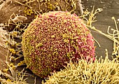 Cell infected with HIV,SEM