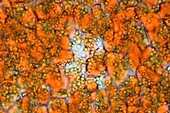 Jatropha curcas oil,light micrograph