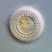 Trichodina parasite,light micrograph