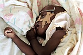 Baby patient,Uganda