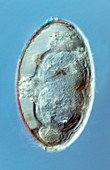 Liver fluke egg,macro photograph