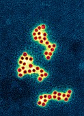 Norovirus particles,TEM