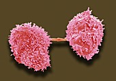 Dividing cancer cells,SEM