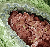 Elastic artery cross-section,SEM