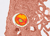 Bacterial invasion of lung epithelium