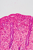 Cross-section of the human vagina. LM