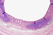Cross-section of the human appendix