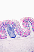 Cross-section of the human colon