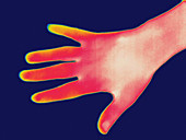 Thermogram,hand,temperature variation