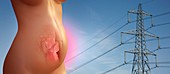 Affect of power lines on pregnancy
