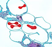 Lung alveoli and red blood cells,TEM