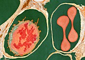 Lung alveoli and blood cells,TEM