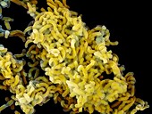Helicobacter pylori bacteria,SEM