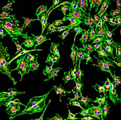 Pulmonary artery cells