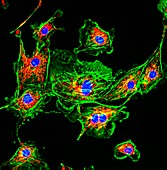 Pulmonary artery cells