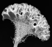 Cockscombs (Celosia sp.),X-ray