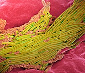 Clostridium difficile bacteria,SEM