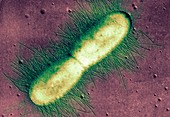 E. coli bacterium,TEM