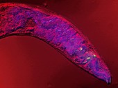 Caenorhabditis elegans,micrograph