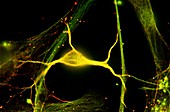 Hippocampal neuron fluorescent micrograph