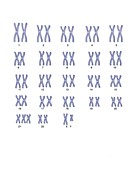 Male Down's syndrome karyotype,artwork