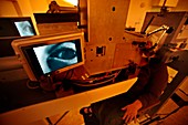 Proton beam therapy for eye tumours