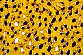 Strychnine seed tissue,light micrograph