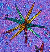 Stellate plant hair,light micrograph
