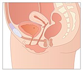 Female pelvic anatomy,artwork