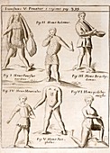 1662 Schott deformities real and imagined