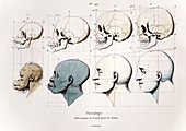 1760a Petrus Camper facial angle eugenics
