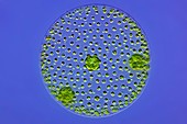 Volvox colony,light micrograph