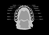 Human tooth anatomy,diagram