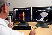 Radiologist assessing scans