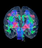 Brain white matter,3D MRI scan