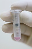 Malaria vaccine research