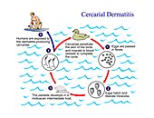 Cercarial dermatitis parasite life cycle