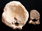 Dinosaur and elephant vertebrae