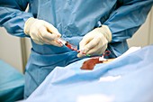 Coronary angioplasty surgery
