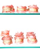 Dental moulds